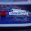 Plošné testování na covid-19