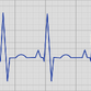 EKG