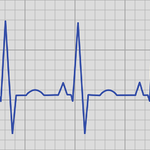 Zátěžové EKG